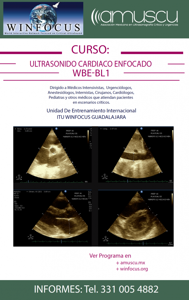 WINFOCUS Ecocardiografia Basica Enfocada